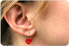 Otoplasty (Ear Surgery)