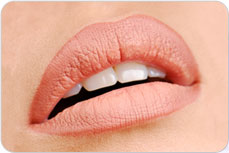 Upper Lip Lift