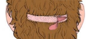 Hair grafts Hair grafts